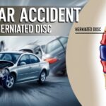 Can a Car Accident Cause a Herniated Disc